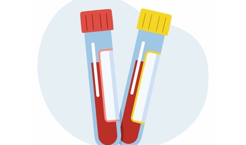 Biochemistry- Red & Yellow tubes