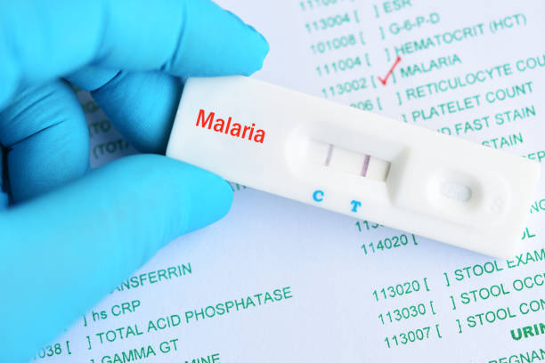 Malaria positive test result by using rapid test cassette