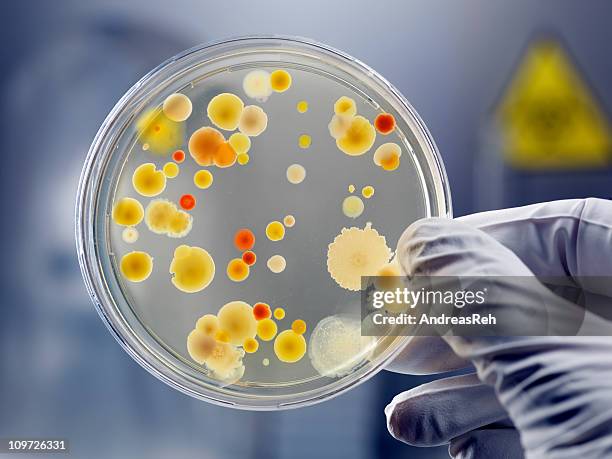 Clean culture of aerobic bacteria on agar plate, biohazard sign in background. Selective focus on petri dish, slightly blue toned, AdobeRGB color profile. Content of my lightbox medical & sciences: